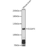 Western Blot - Anti-DLGAP3 Antibody (A307691) - Antibodies.com