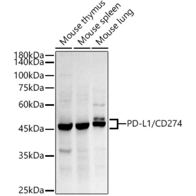 Western Blot - Anti-PD-L1 Antibody [ARC2478] (A307692) - Antibodies.com