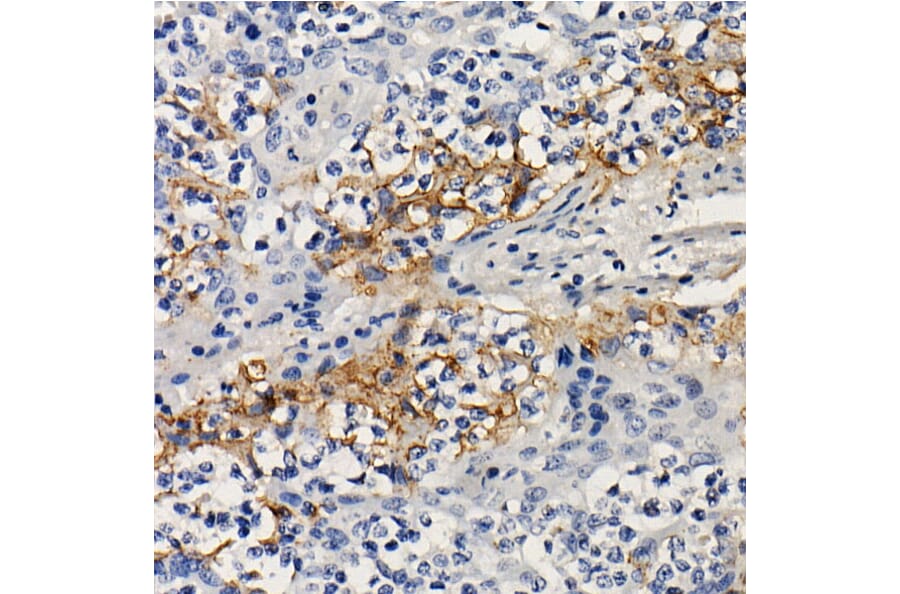 Immunohistochemistry - Anti-PD-L1 Antibody [ARC2478] (A307692) - Antibodies.com