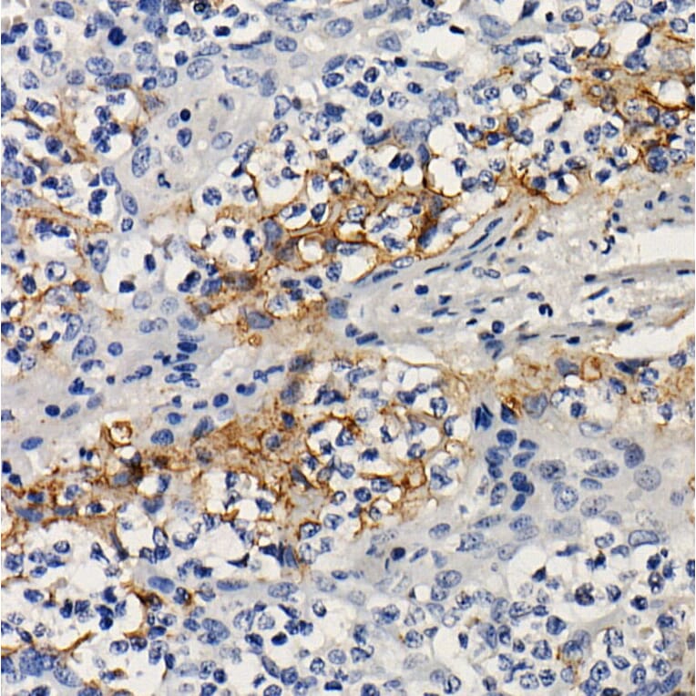 Immunohistochemistry - Anti-PD-L1 Antibody [ARC2478] (A307692) - Antibodies.com