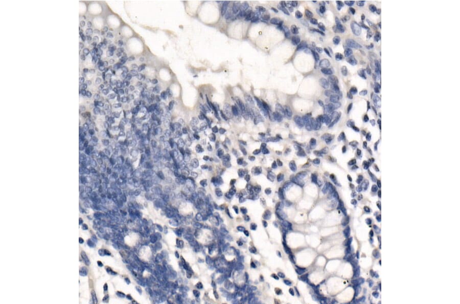 Immunohistochemistry - Anti-PD-L1 Antibody [ARC2478] (A307692) - Antibodies.com
