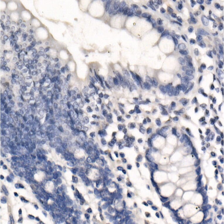 Immunohistochemistry - Anti-PD-L1 Antibody [ARC2478] (A307692) - Antibodies.com