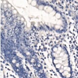 Immunohistochemistry - Anti-PD-L1 Antibody [ARC2478] (A307692) - Antibodies.com