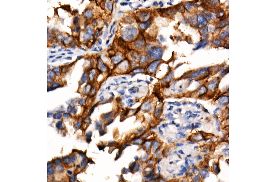 Immunohistochemistry - Anti-PD-L1 Antibody [ARC2478] (A307692) - Antibodies.com
