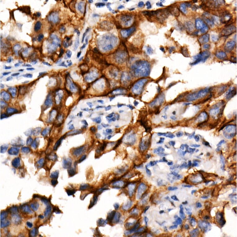 Immunohistochemistry - Anti-PD-L1 Antibody [ARC2478] (A307692) - Antibodies.com