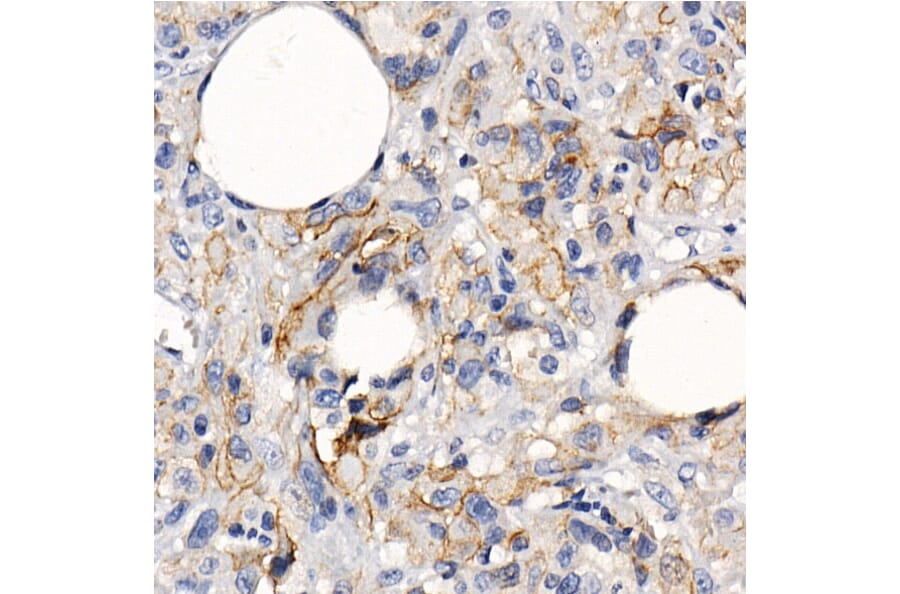 Immunohistochemistry - Anti-PD-L1 Antibody [ARC2478] (A307692) - Antibodies.com