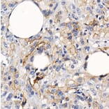 Immunohistochemistry - Anti-PD-L1 Antibody [ARC2478] (A307692) - Antibodies.com