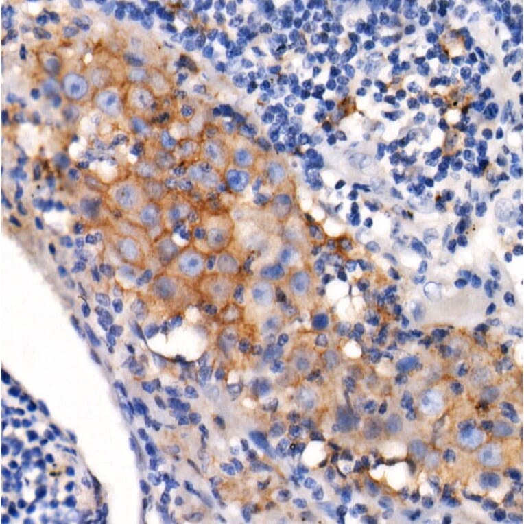 Immunohistochemistry - Anti-PD-L1 Antibody [ARC2478] (A307692) - Antibodies.com