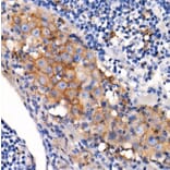 Immunohistochemistry - Anti-PD-L1 Antibody [ARC2478] (A307692) - Antibodies.com