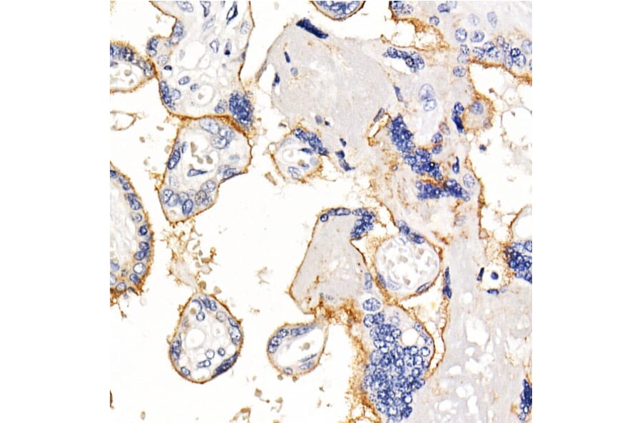 Immunohistochemistry - Anti-PD-L1 Antibody [ARC2478] (A307692) - Antibodies.com