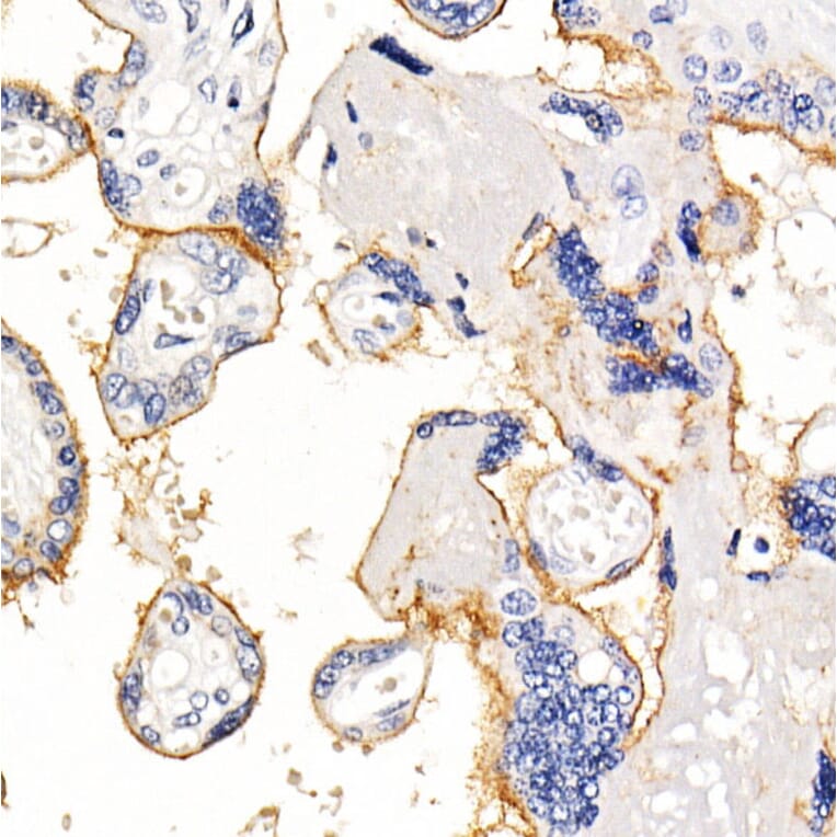 Immunohistochemistry - Anti-PD-L1 Antibody [ARC2478] (A307692) - Antibodies.com