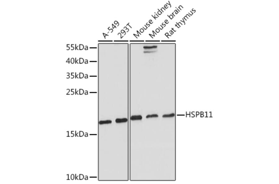 Western Blot - Anti-C1orf41 Antibody (A307693) - Antibodies.com