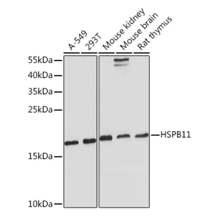 Western Blot - Anti-C1orf41 Antibody (A307693) - Antibodies.com