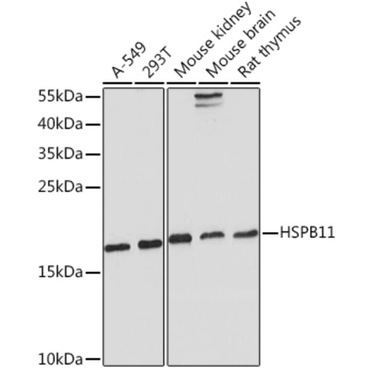 Western Blot - Anti-C1orf41 Antibody (A307693) - Antibodies.com