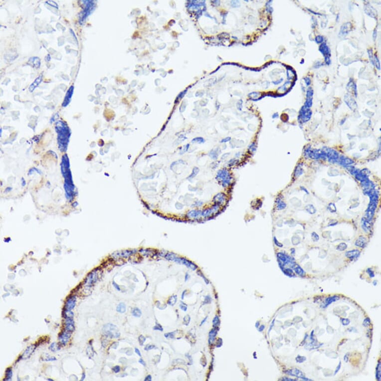 Immunohistochemistry - Anti-C1orf41 Antibody (A307693) - Antibodies.com