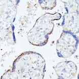 Immunohistochemistry - Anti-C1orf41 Antibody (A307693) - Antibodies.com