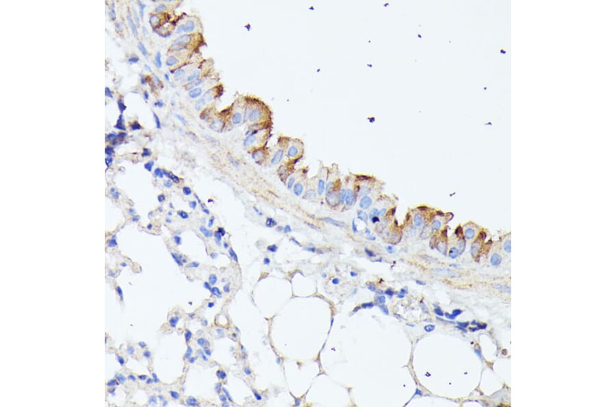 Immunohistochemistry - Anti-C1orf41 Antibody (A307693) - Antibodies.com