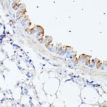 Immunohistochemistry - Anti-C1orf41 Antibody (A307693) - Antibodies.com