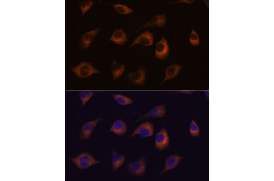 Immunofluorescence - Anti-C1orf41 Antibody (A307693) - Antibodies.com