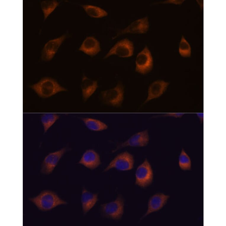 Immunofluorescence - Anti-C1orf41 Antibody (A307693) - Antibodies.com