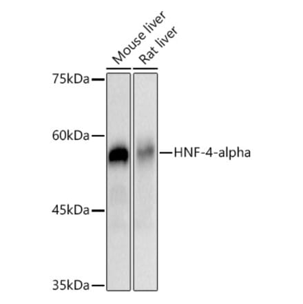 Western Blot - Anti-HNF-4-alpha Antibody [ARC2794] (A307694) - Antibodies.com