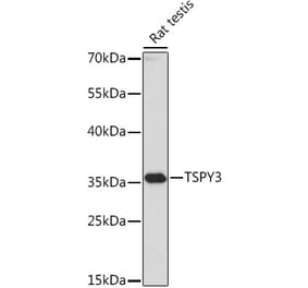 Western Blot - Anti-TSPY3 Antibody (A307695) - Antibodies.com