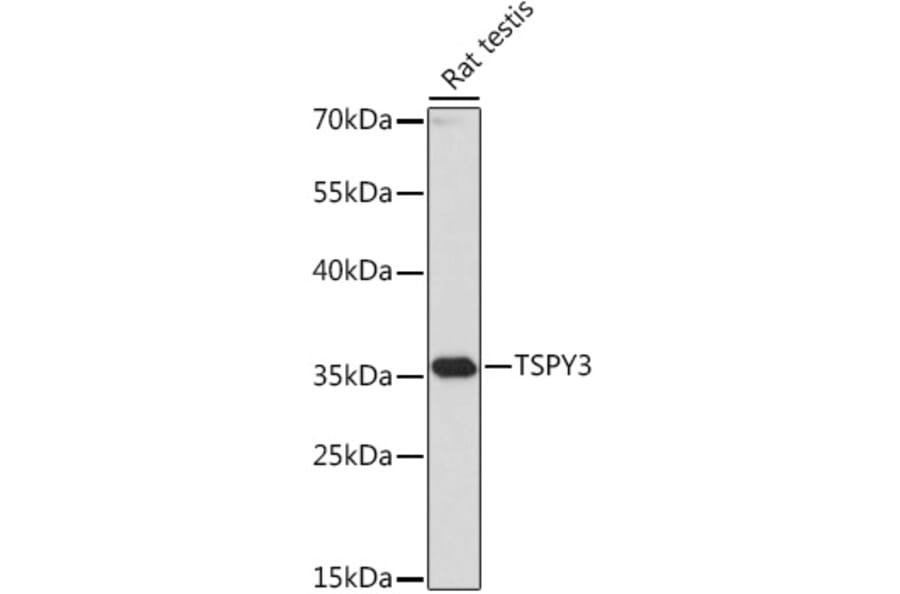 Western Blot - Anti-TSPY3 Antibody (A307695) - Antibodies.com