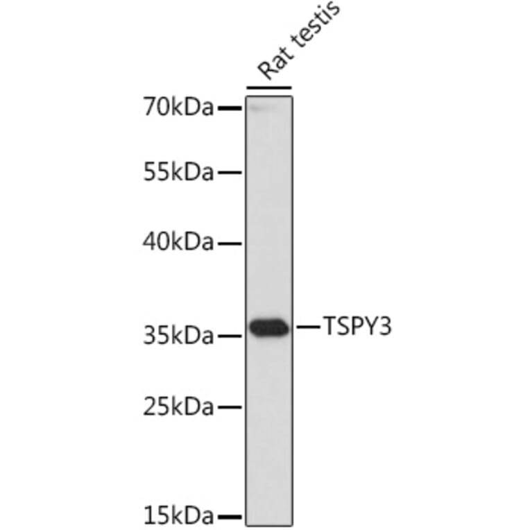 Western Blot - Anti-TSPY3 Antibody (A307695) - Antibodies.com
