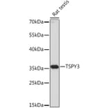 Western Blot - Anti-TSPY3 Antibody (A307695) - Antibodies.com