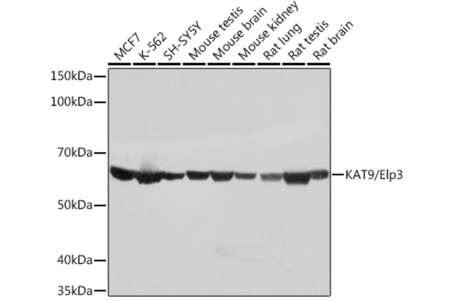 Western Blot - Anti-KAT9/Elp3 Antibody [ARC1806] (A307696) - Antibodies.com