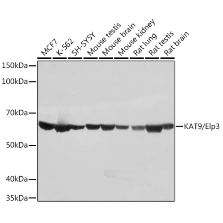 Western Blot - Anti-KAT9/Elp3 Antibody [ARC1806] (A307696) - Antibodies.com