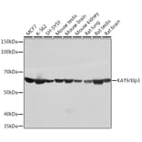 Western Blot - Anti-KAT9/Elp3 Antibody [ARC1806] (A307696) - Antibodies.com