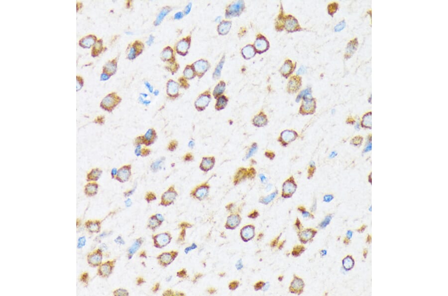 Immunohistochemistry - Anti-KAT9/Elp3 Antibody [ARC1806] (A307696) - Antibodies.com