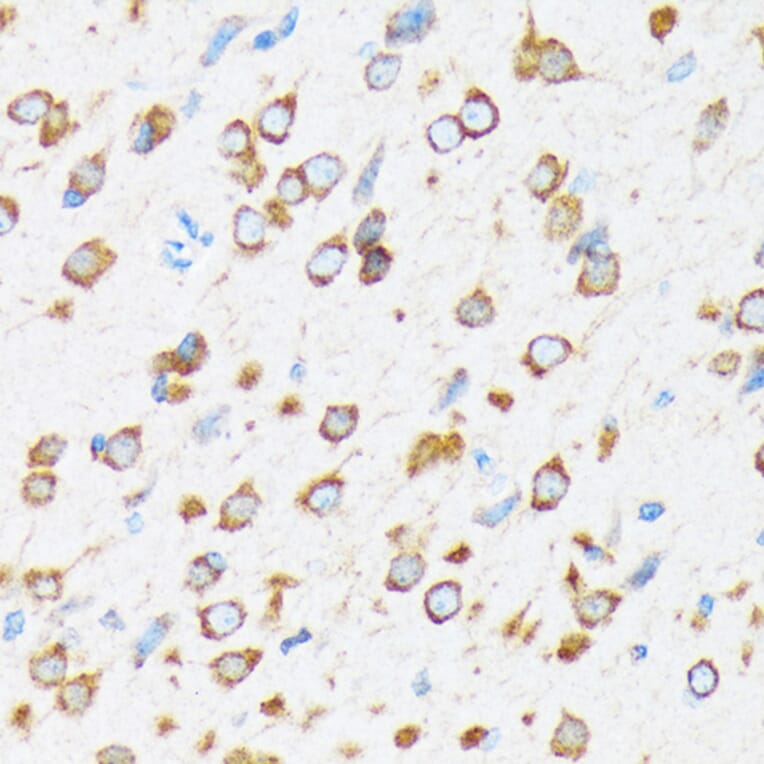 Immunohistochemistry - Anti-KAT9/Elp3 Antibody [ARC1806] (A307696) - Antibodies.com