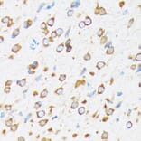 Immunohistochemistry - Anti-KAT9/Elp3 Antibody [ARC1806] (A307696) - Antibodies.com