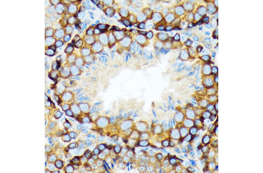 Immunohistochemistry - Anti-KAT9/Elp3 Antibody [ARC1806] (A307696) - Antibodies.com
