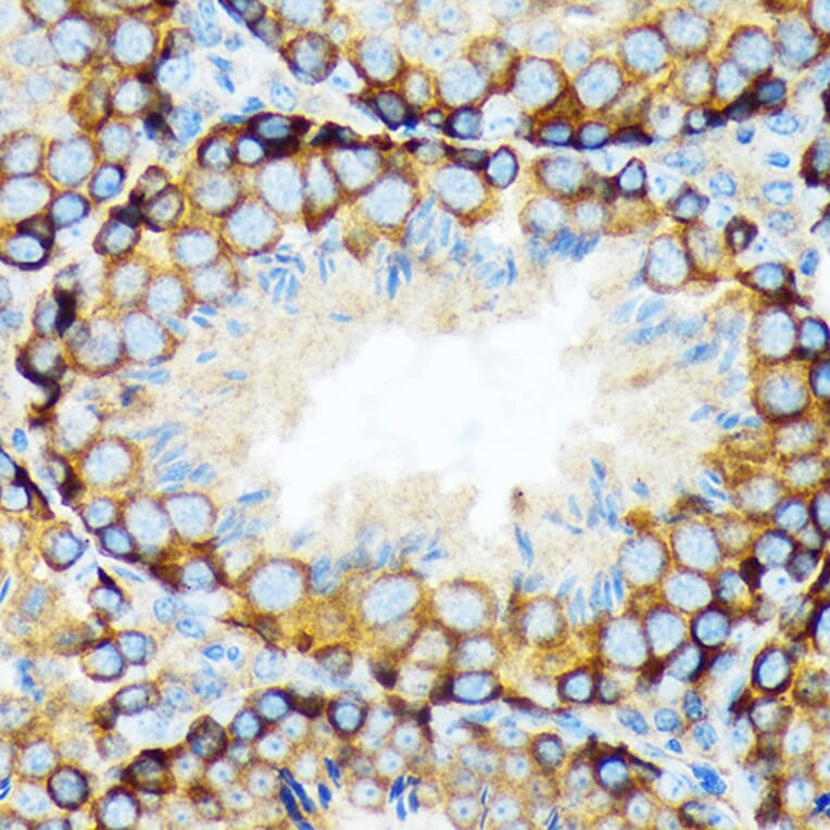 Immunohistochemistry - Anti-KAT9/Elp3 Antibody [ARC1806] (A307696) - Antibodies.com