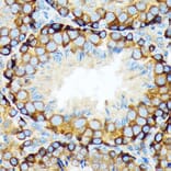 Immunohistochemistry - Anti-KAT9/Elp3 Antibody [ARC1806] (A307696) - Antibodies.com