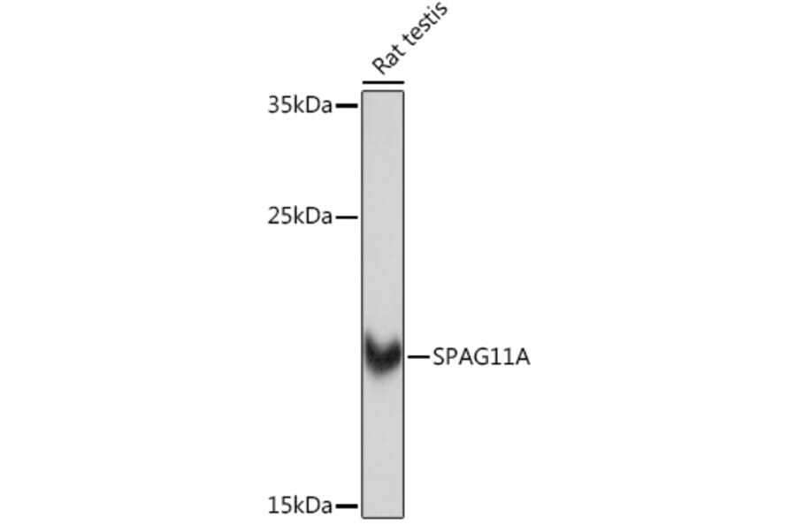 Western Blot - Anti-SPAG11A Antibody (A307697) - Antibodies.com