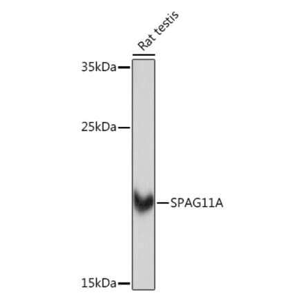 Western Blot - Anti-SPAG11A Antibody (A307697) - Antibodies.com