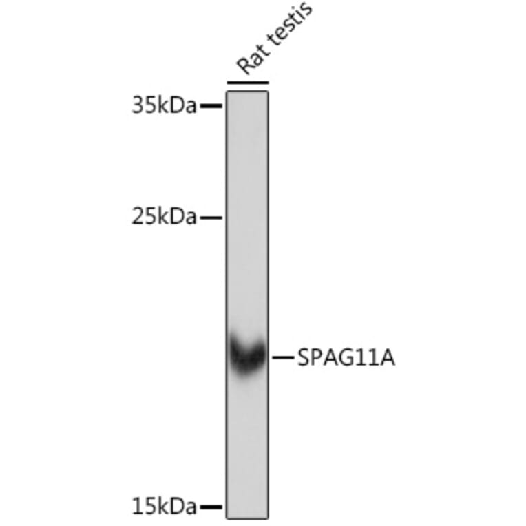 Western Blot - Anti-SPAG11A Antibody (A307697) - Antibodies.com