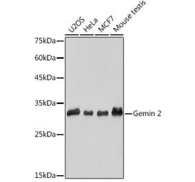 Western Blot - Anti-Gemin 2 Antibody [ARC2419] (A307698) - Antibodies.com