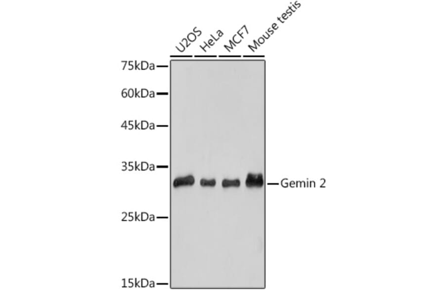 Western Blot - Anti-Gemin 2 Antibody [ARC2419] (A307698) - Antibodies.com