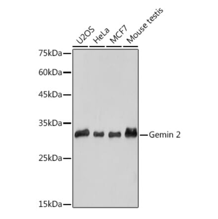 Western Blot - Anti-Gemin 2 Antibody [ARC2419] (A307698) - Antibodies.com