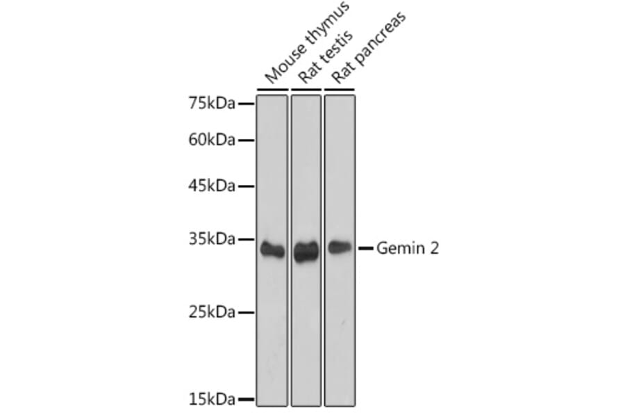 Western Blot - Anti-Gemin 2 Antibody [ARC2419] (A307698) - Antibodies.com