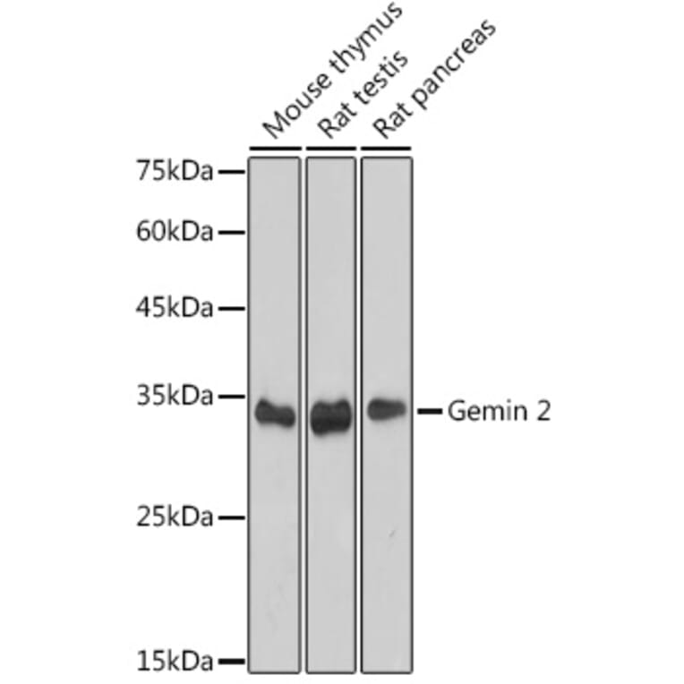 Western Blot - Anti-Gemin 2 Antibody [ARC2419] (A307698) - Antibodies.com