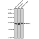 Western Blot - Anti-Gemin 2 Antibody [ARC2419] (A307698) - Antibodies.com