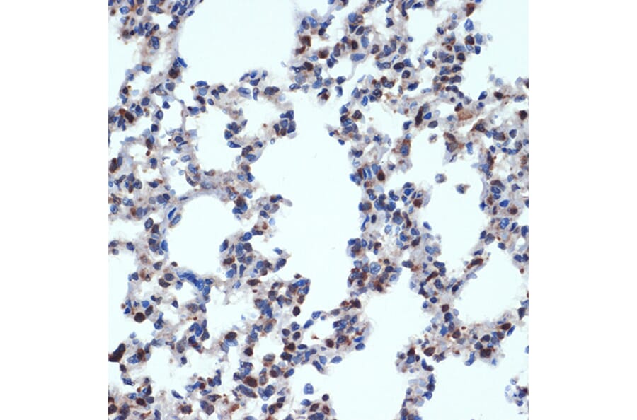 Immunohistochemistry - Anti-Gemin 2 Antibody [ARC2419] (A307698) - Antibodies.com