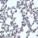 Immunohistochemistry - Anti-Gemin 2 Antibody [ARC2419] (A307698) - Antibodies.com