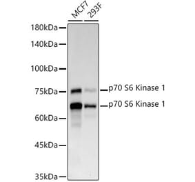 Western Blot - Anti-S6K1 Antibody [ARC57223] (A307700) - Antibodies.com